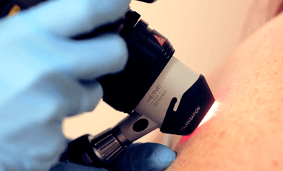 diagnostic methods for the plantar wart